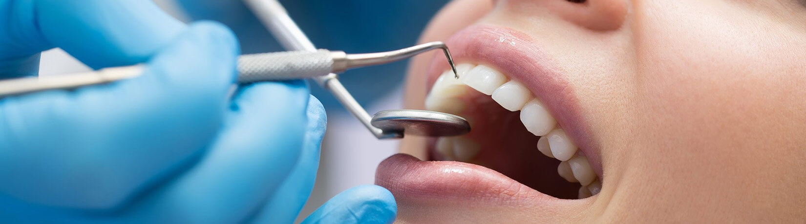 Зубний камінь: причини виникнення та методи боротьби з цією проблемою
